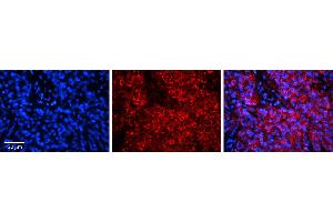 Rabbit Anti-HERC5 Antibody     Formalin Fixed Paraffin Embedded Tissue: Human Pineal Tissue  Observed Staining: Cytoplasmic in cell bodies and processes of pinealocytes  Primary Antibody Concentration: 1:100  Other Working Concentrations: 1/600  Secondary Antibody: Donkey anti-Rabbit-Cy3  Secondary Antibody Concentration: 1:200  Magnification: 20X  Exposure Time: 0. (HERC5 antibody  (Middle Region))