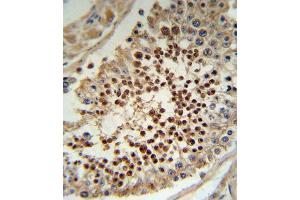 Immunohistochemistry (IHC) image for anti-Kruppel-Like Factor 5 (Intestinal) (KLF5) antibody (ABIN3003155) (KLF5 antibody)