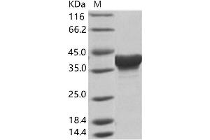 Western Blotting (WB) image for Zaire Ebolavirus VP40 (ZEBOV VP40) protein (His tag) (ABIN7198934) (ZEBOV VP40 Protein (His tag))