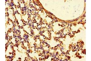Immunohistochemistry of paraffin-embedded human lung tissue using ABIN7165823 at dilution of 1:100 (TTLL8 antibody  (AA 671-822))