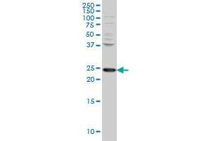 PCMT1 monoclonal antibody (M02), clone 1D6 Western Blot analysis of PCMT1 expression in HeLa . (PCMT1 antibody  (AA 117-225))