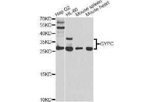 Western blot analysis of extracts of various cell lines, using GYPC antibody (ABIN5970574) at 1/1000 dilution. (CD236/GYPC antibody)