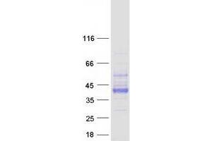 Western Blotting (WB) image for Basigin (Ok Blood Group) (BSG) (Transcript Variant 2) protein (Myc-DYKDDDDK Tag) (ABIN2713429)