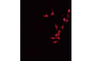 ABIN6266517 staining HeLa cells by IF/ICC. (Connexin 43/GJA1 antibody  (Internal Region))