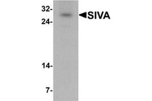 Western blot analysis of SIVA in mouse liver tissue lysate with SIVA antibody at 1 ug/mL. (SIVA1 antibody  (N-Term))