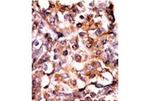 Image no. 2 for anti-Mitogen-Activated Protein Kinase-Activated Protein Kinase 2 (MAPKAPK2) (pSer272) antibody (ABIN358152) (MAPKAP Kinase 2 antibody  (pSer272))