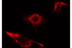 ABIN6274581 staining 293 cells by IF/ICC. (ADD2 antibody  (Internal Region))