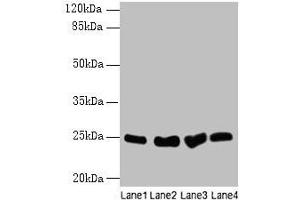 Western blot All lanes: Socs3 antibody at 12 μg/mL Lane 1: K562 whole cell lysate Lane 2: A375 whole cell lysate Lane 3: Hela whole cell lysate Lane 4: HepG2 whole cell lysate Secondary Goat polyclonal to rabbit IgG at 1/10000 dilution Predicted band size: 25 kDa Observed band size: 25 kDa (SOCS3 antibody  (AA 1-225))