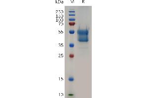 Human CD235A Protein, hFc Tag on SDS-PAGE under reducing condition. (CD235a/GYPA Protein (AA 28-91) (Fc Tag))