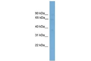 WB Suggested Anti-SLC40A1 Antibody Titration:  0. (SLC40A1 antibody  (Middle Region))