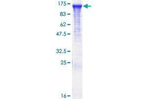 Image no. 1 for RAB GTPase Activating Protein 1 (RABGAP1) (AA 1-997) protein (GST tag) (ABIN1317229) (RABGAP1 Protein (AA 1-997) (GST tag))