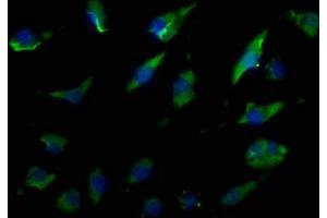 Immunofluorescence staining of U251 cells with ABIN7140169 at 1:50, counter-stained with DAPI. (TJP1 antibody  (AA 116-138))