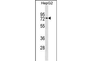 Western blot analysis in HepG2 cell line lysates (35ug/lane). (ZNF614 antibody  (AA 174-200))