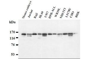 Western Blotting (WB) image for anti-Splicing Factor 3b, Subunit 1, 155kDa (SF3B1) antibody (ABIN1449178) (SF3B1 antibody)