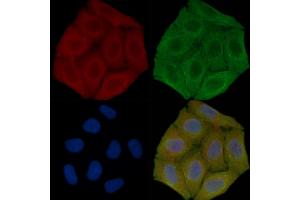 ABIN7096271 and ABIN7100333 staining Hela cells(30 min of UV treatment) by IF/ICC. (RNF145 antibody)