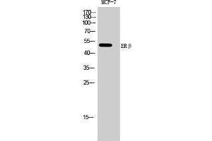 Western Blotting (WB) image for anti-Estrogen Receptor 2 (ESR2) (Ser368) antibody (ABIN3175029) (ESR2 antibody  (Ser368))