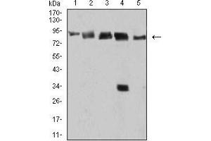 Western blot analysis using DDX1 mouse mAb against Hela (1), MCF-7 (2), A431 (3), PC-3 (4), and Jurkat (5) cell lysate. (DDX1 antibody  (AA 642-740))