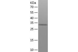 Western Blotting (WB) image for Malate Dehydrogenase 2, NAD (Mitochondrial) (MDH2) (AA 25-338) protein (His tag) (ABIN7123837) (MDH2 Protein (AA 25-338) (His tag))