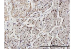 Immunoperoxidase of monoclonal antibody to DTX3L on formalin-fixed paraffin-embedded human pancreas.