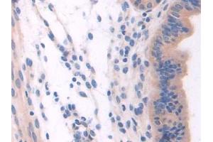 DAB staining on IHC-P; Samples: Mouse Uterus Tissue (NSP5 antibody  (AA 961-1063))