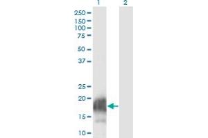 Western Blot analysis of CARHSP1 expression in transfected 293T cell line by CARHSP1 monoclonal antibody (M08), clone 4G10. (CARHSP1 antibody  (AA 1-147))