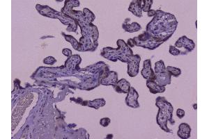 IHC analysis of CIC using anti-CIC antibody (ABIN6719536).
