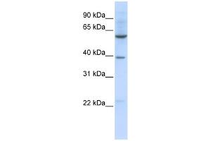 WB Suggested Anti-SLC35F3 Antibody Titration:  0. (SLC35F3 antibody  (Middle Region))