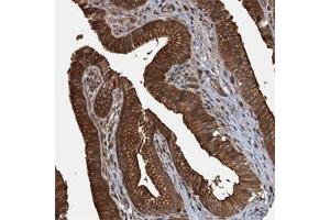 Immunohistochemical staining of human gallbladder with APOL5 polyclonal antibody  shows strong cytoplasmic and membranous positivity in glandular cells at 1:50-1:200 dilution.