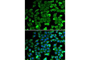 Immunofluorescence analysis of HeLa cells using SIRT2 antibody. (SIRT2 antibody)