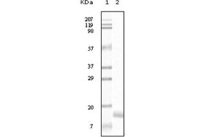 Western Blotting (WB) image for anti-Synuclein, gamma (Breast Cancer-Specific Protein 1) (SNCG) antibody (ABIN1107306) (SNCG antibody)