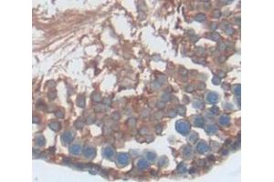 Used in DAB staining on fromalin fixed paraffin- embedded Kidney tissue (S100A16 antibody  (AA 1-97))