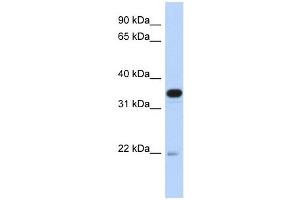 PITPNB antibody used at 1 ug/ml to detect target protein. (PITPNB antibody  (Middle Region))