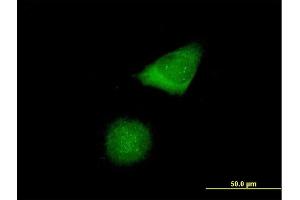 Immunofluorescence of purified MaxPab antibody to CENPH on HeLa cell. (CENPH antibody  (AA 1-247))
