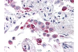 Human Lung: Formalin-Fixed, Paraffin-Embedded (FFPE) (EFHD1 antibody  (N-Term))