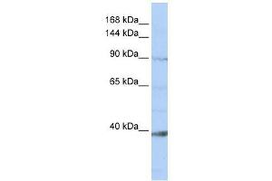 NCKAP1L antibody used at 0. (NCKAP1L antibody  (N-Term))