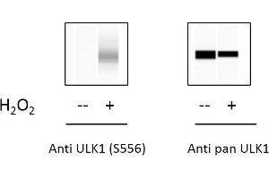 C2C12 cells were untreated or treated with 1mM H2O2 for 15 min. (ULK1 ELISA Kit)