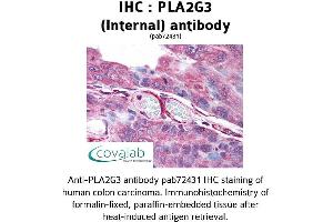 Image no. 1 for anti-Phospholipase A2, Group III (PLA2G3) (Internal Region) antibody (ABIN1738136) (PLA2G3 antibody  (Internal Region))