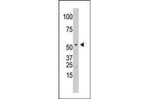 The SPPL2A polyclonal antibody  is used in Western blot to detect SPPL2A in Jurkat cell lysate.