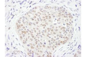 Immunohistochemistry (IHC) image for anti-Thymine-DNA Glycosylase (TDG) (AA 360-410) antibody (ABIN7455026) (TDG antibody  (AA 360-410))