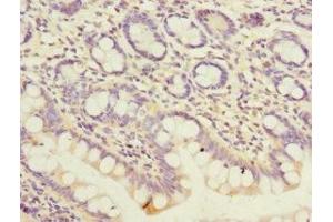 Immunohistochemistry of paraffin-embedded human small intestine tissue using ABIN7162961 at dilution of 1:100 (PEX19 antibody  (AA 1-299))