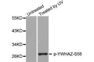 Western blot analysis of extracts from Hela cells, using Phospho-YWHAZ-S58 antibody. (14-3-3 zeta antibody  (pSer58))