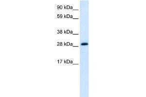 WB Suggested Anti-ABT1 Antibody Titration:  1. (Activator of Basal Transcription 1 antibody  (Middle Region))