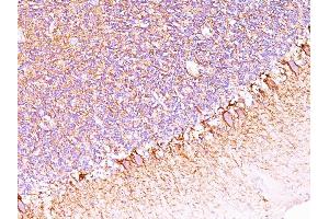 Formalin-fixed, paraffin-embedded human Cerebellum stained with Neurofilament Monoclonal Antibody (SPM563). (NEFH antibody)