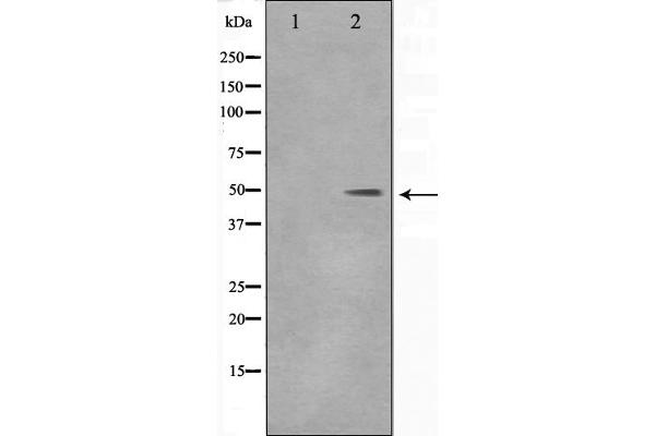 DLX3 antibody  (Internal Region)