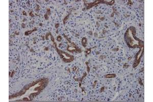 Immunohistochemistry on paraffin sections of human pancreas epithelia strongly positive (Cytokeratin 7 antibody)