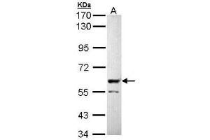Western Blot analysis: PPP3CB antibody staining of Molt-4 whole cell lysate (Lane A, 30 µg) at 1/5000 dilution. (PPP3CB antibody)