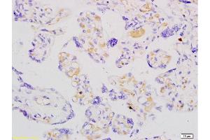 Formalin-fixed and paraffin embedded human placenta labeled with Anti-ADFP Polyclonal Antibody, Unconjugated  at 1:200 followed by conjugation to the secondary antibody and DAB staining. (ADRP antibody  (AA 31-130))