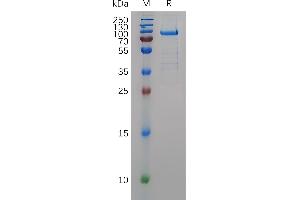 MMP11 Protein (AA 32-488) (Fc Tag)