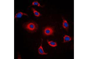 Immunofluorescent analysis of FXR2 staining in HepG2 cells. (FXR2 antibody  (C-Term))