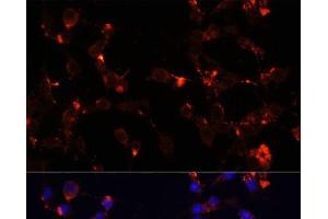Immunofluorescence analysis of NIH/3T3 cells using WDR81 Polyclonal Antibody at dilution of 1:100.